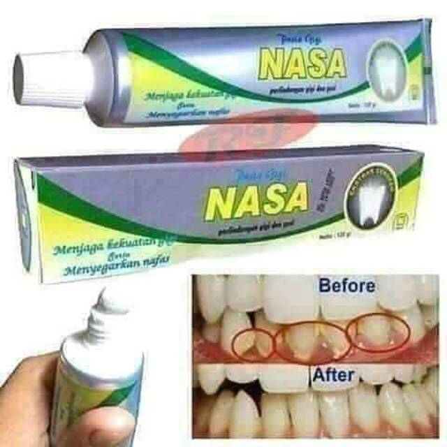 Pasta Gigi nasa