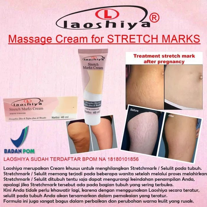 Laoshiya Stretch Marks Cream