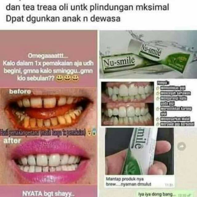 Nu-smile