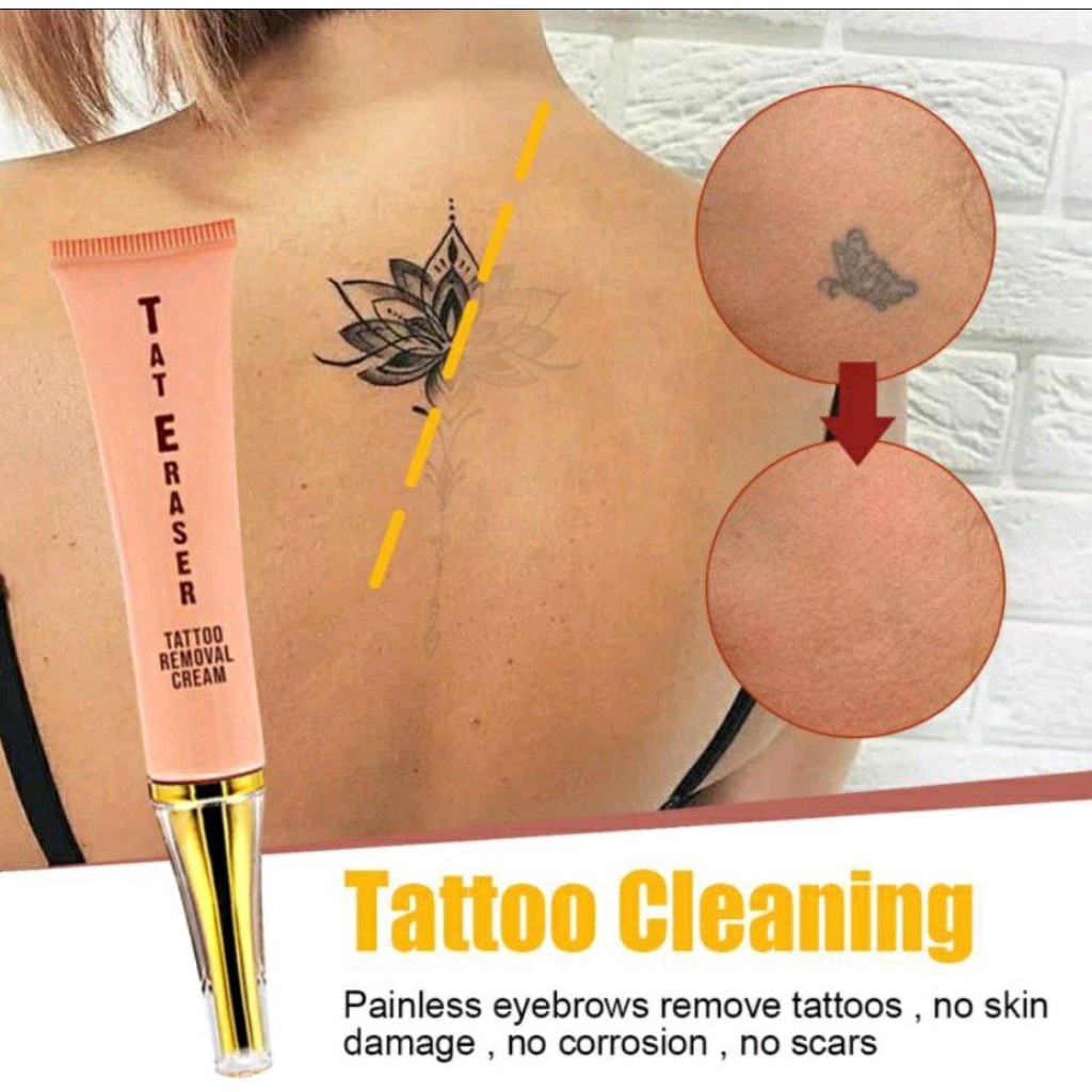 Cream Tato Removal MZ