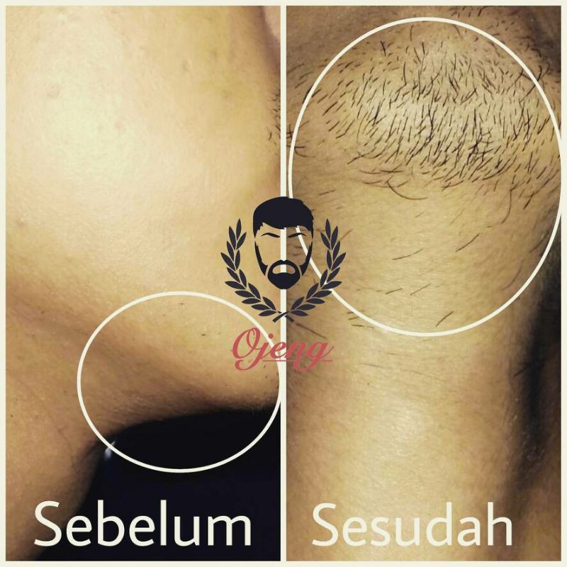 Ojeng Beard Cream