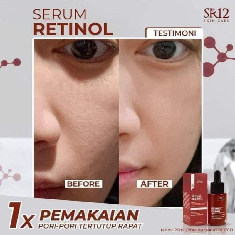 Serum Retinol
