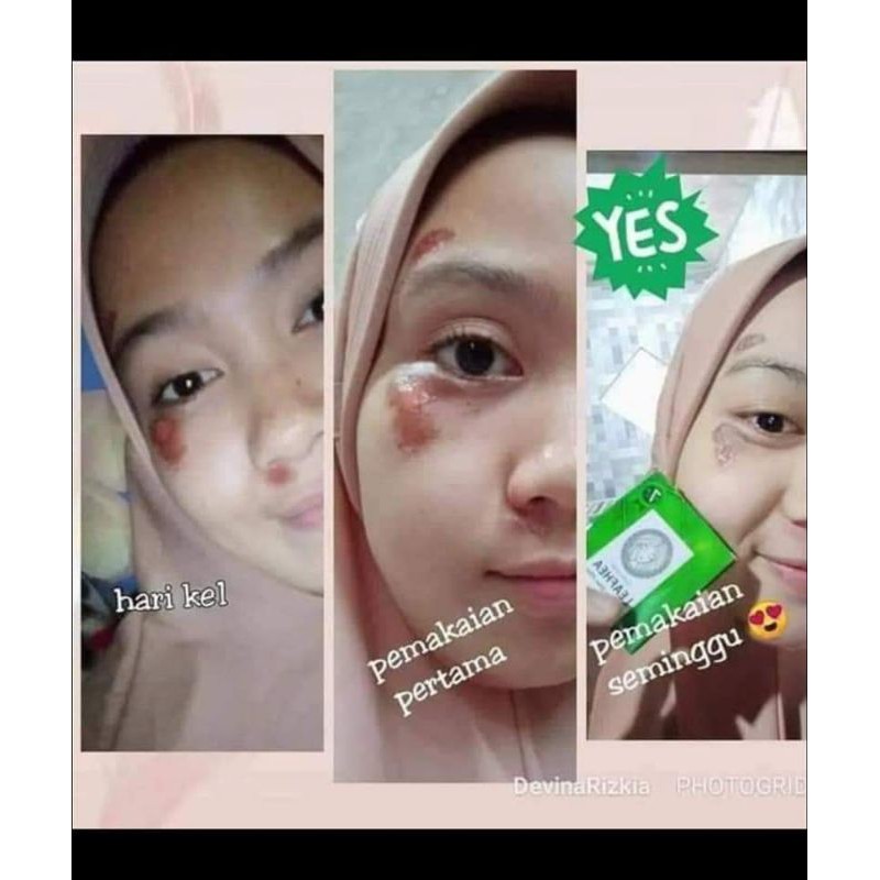 LEAFHEA Glutha Soap ASLI ORIGINAL