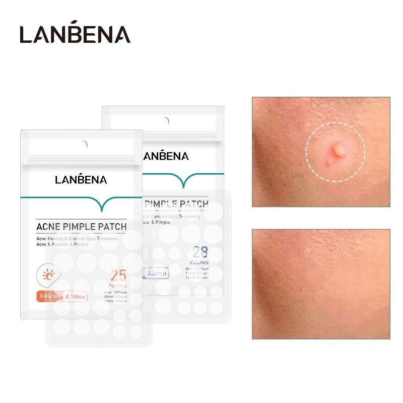 LANBENA Acne Pimple Patch - Stiker Jerawat