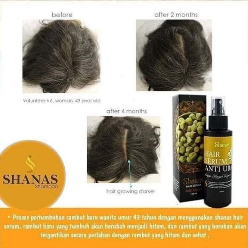 Shanas anti uban