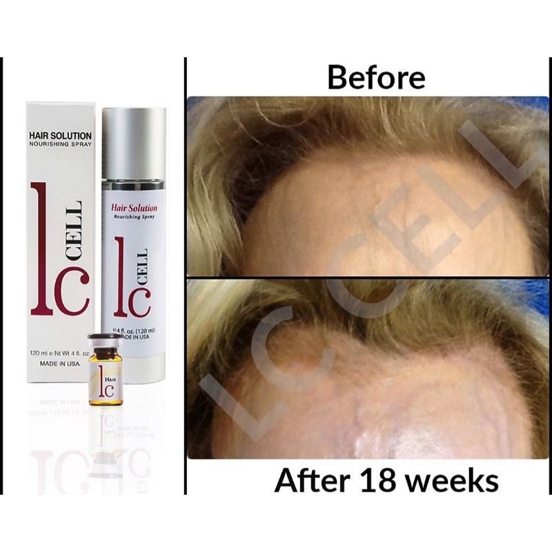 LC CELL HAIR SOLUTION 120ml