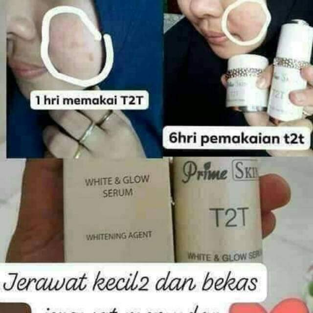 T2t hwi