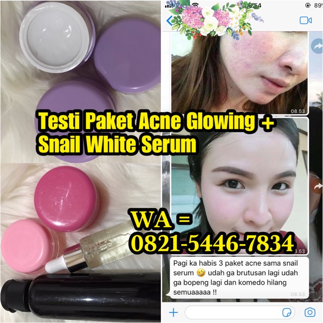Paket acne glowing