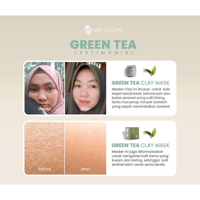 MASKER GREEN TEA MSGLOW