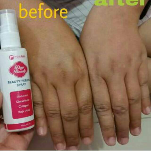 Peeling spray