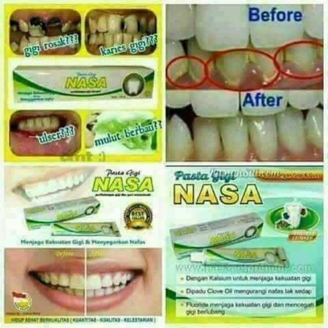 Pasta gigi nasa