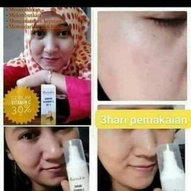 Serum vitC Nasa