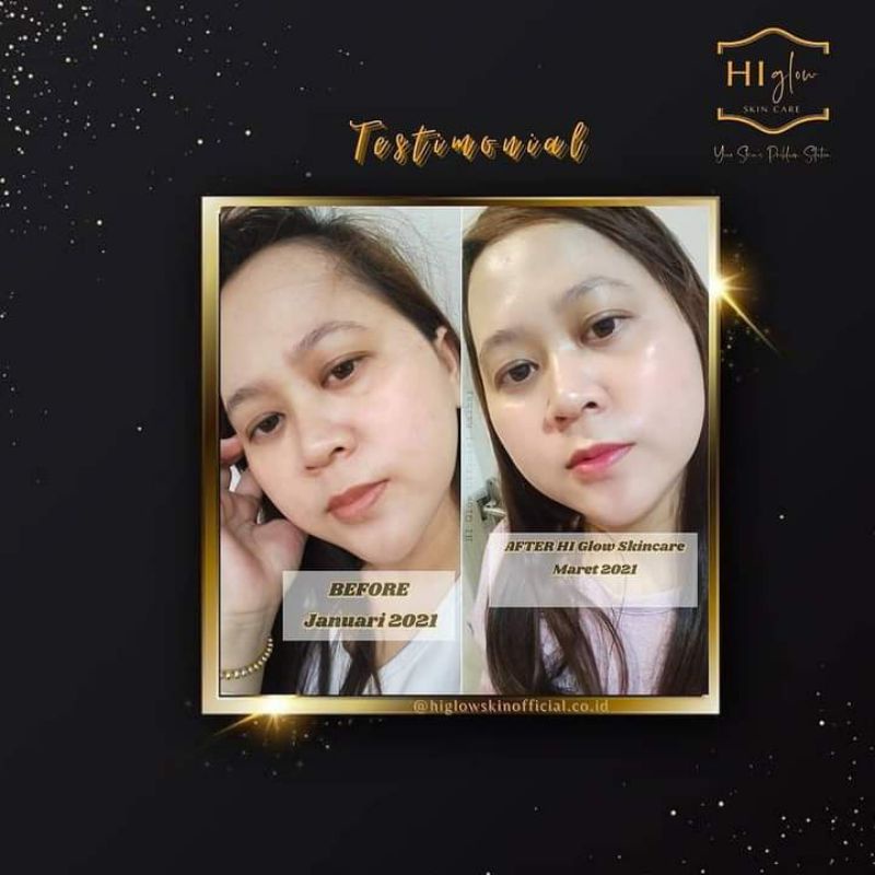 PAKET GLOWING HIGLOW