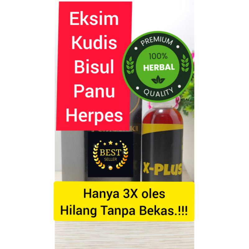 obat gatal kulit
