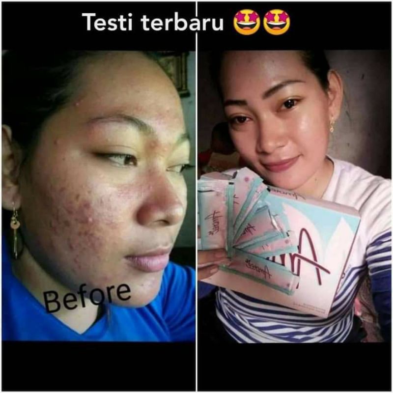 AMOOTE (Perawatan dari dalam)