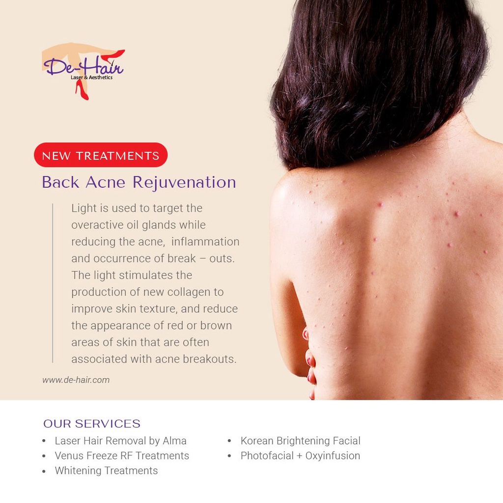 Full Back Acne Rejuvenation Package 5X