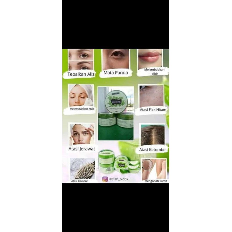 ALOE VERA MSI