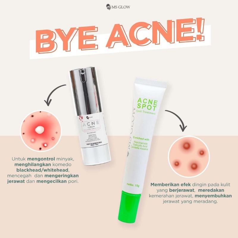 Acne spot ms glow