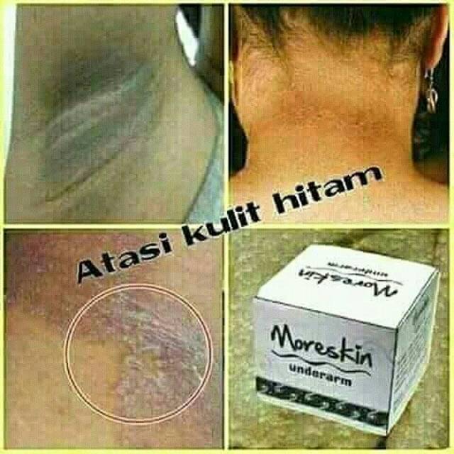 Moreskin Underarm