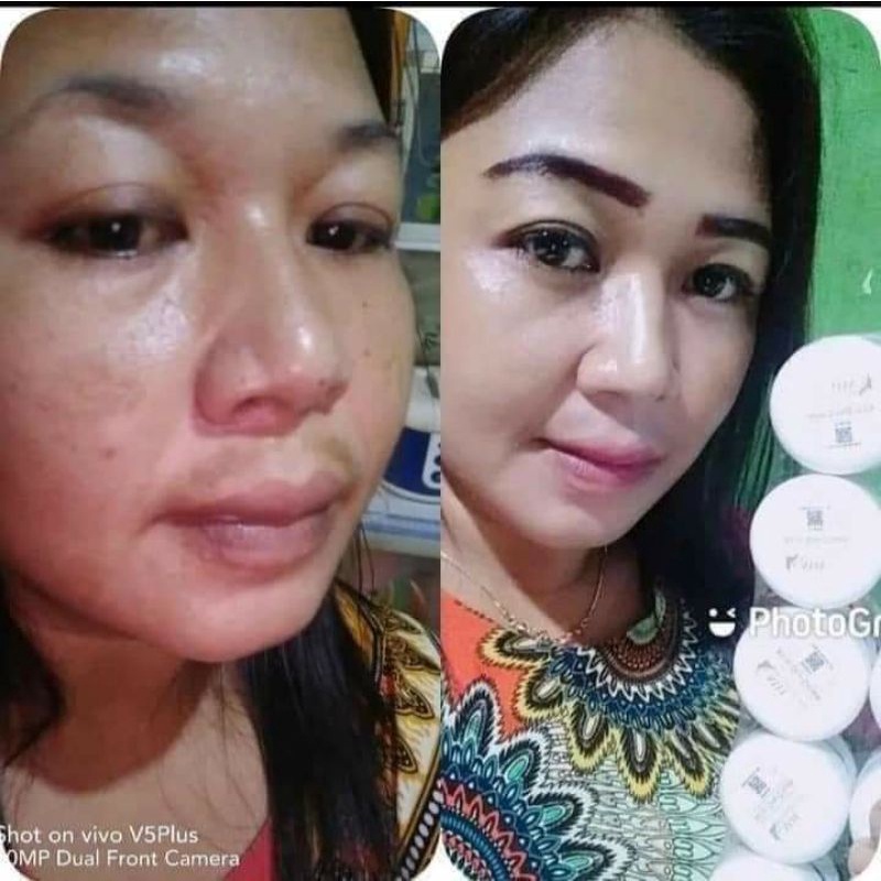 MH whitening skin