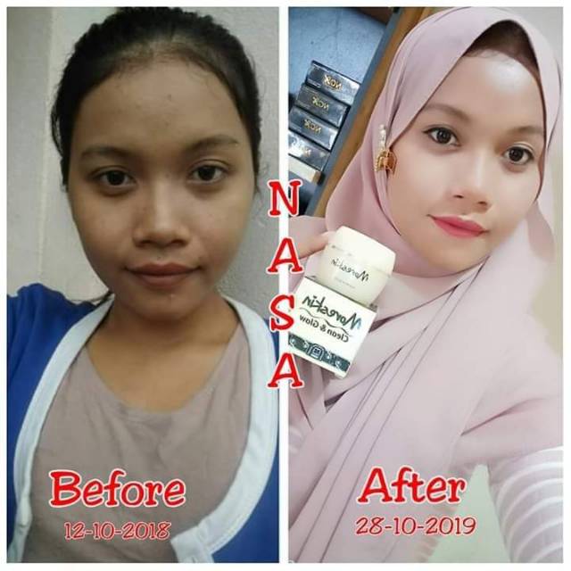 Moreskin clean glow