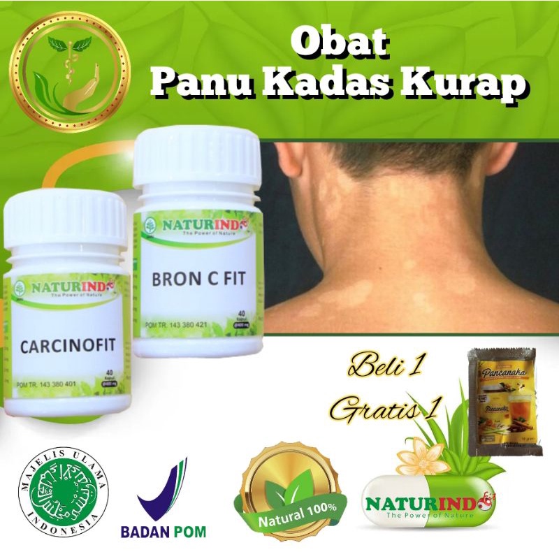 Obat Panu Kadas Kurap