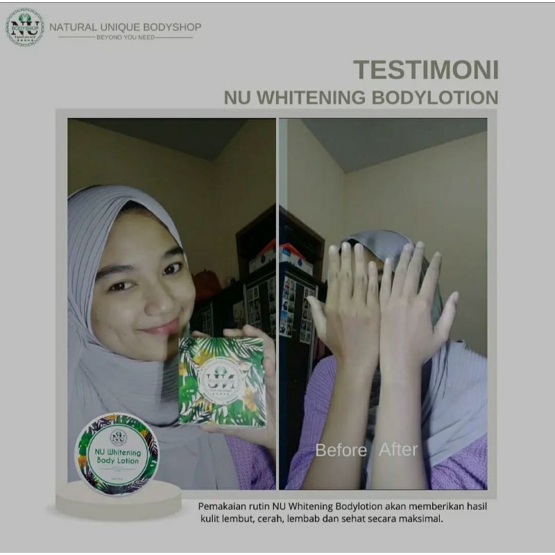 Whitening bodylotion