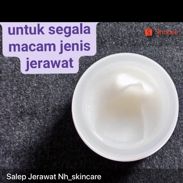 Salep Jerawat Nh