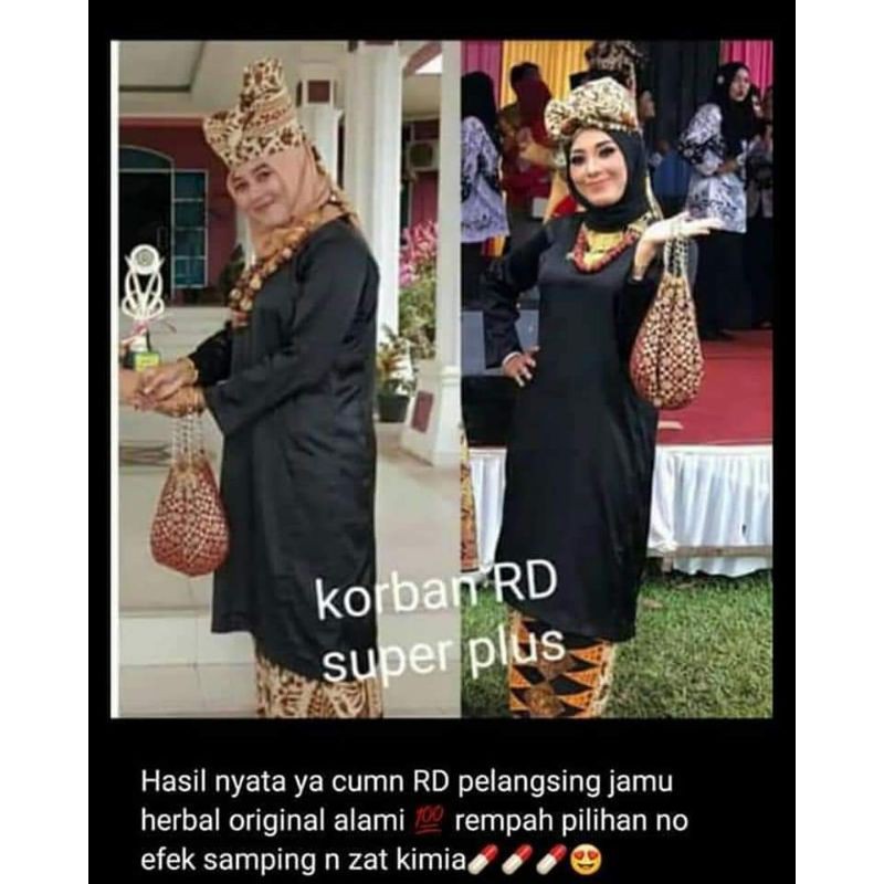 RD pelangsing BPOM