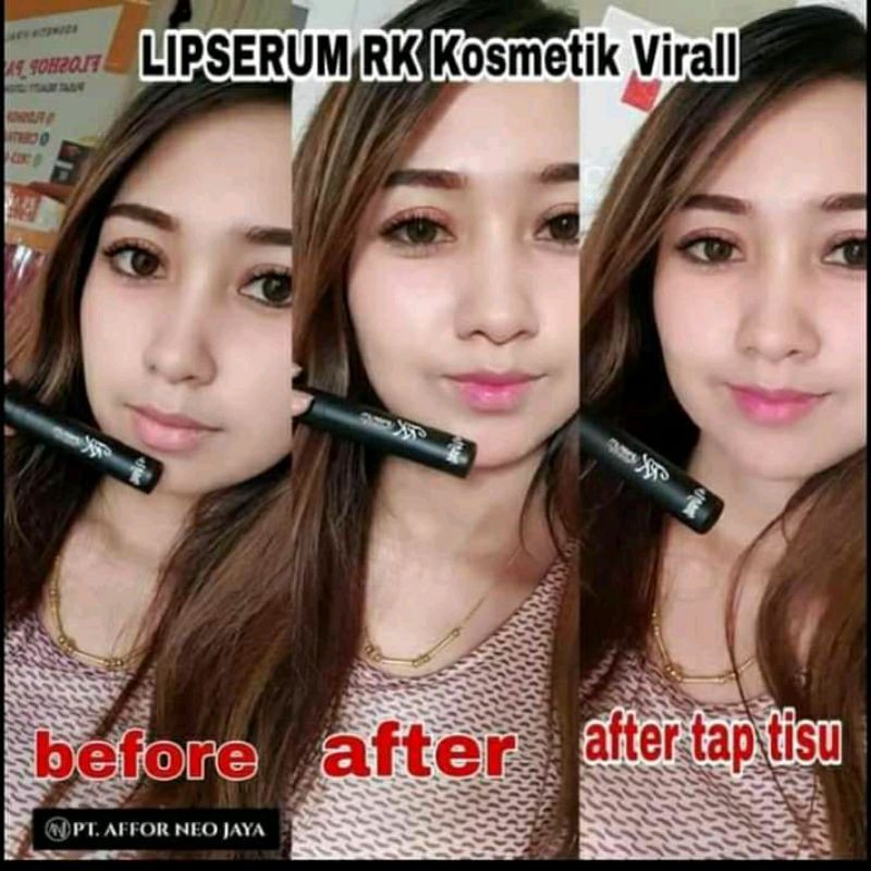 Liptin anj