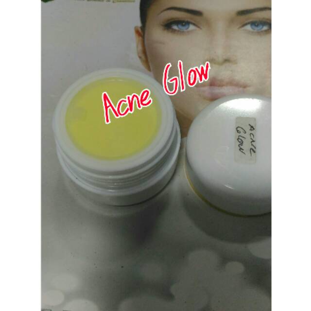CREAM ACNE GLOW