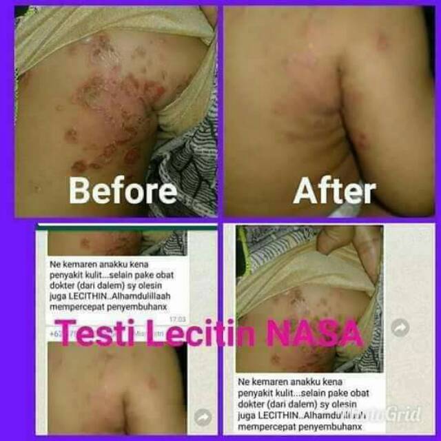 Lecith Nasa herbal BPOM