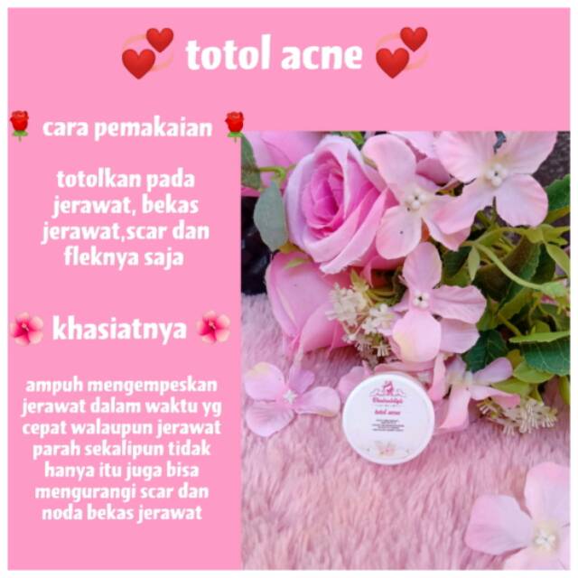Totol Acne