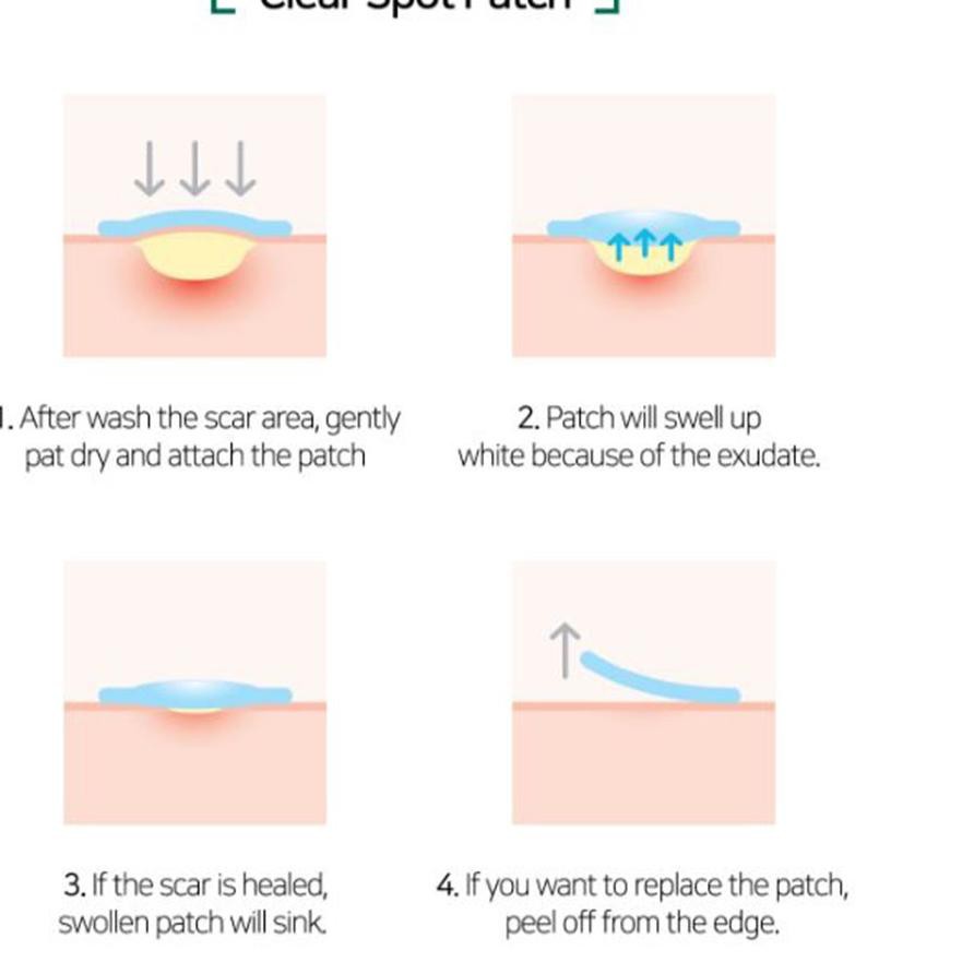 Terbaru!!! SOMEBYMI 30 Days Miracle Clear Spot Patch ,,...,,.