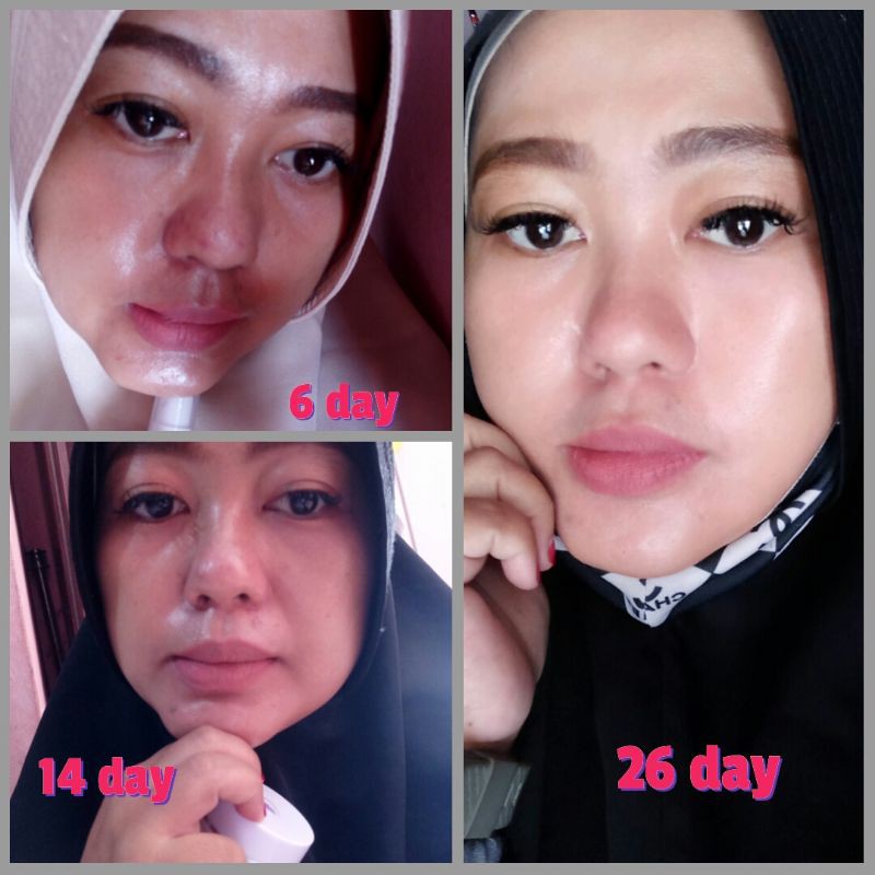 NBS/nonibeautyskincare