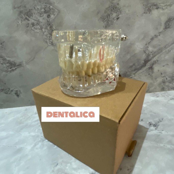 Terlaris Dental Model Study Disease Phantom