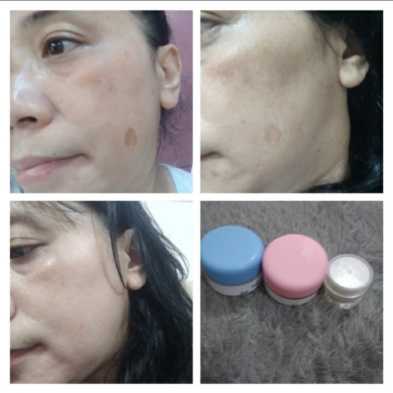 Paket glowing dan putih bebas flek hitam