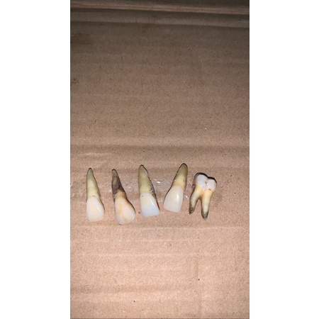molar dan insisivus