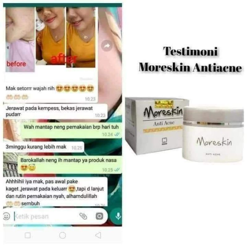 Moreskin