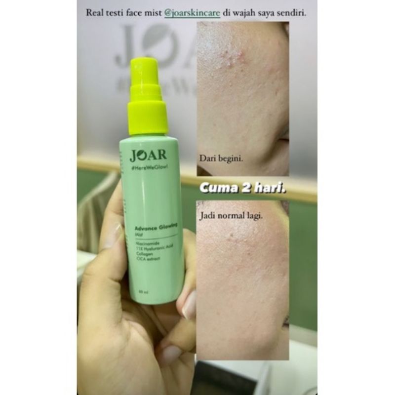 FACE MIST