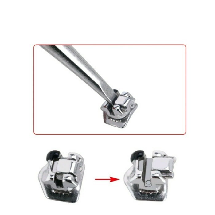 OPENER (SONDE PEMBUKA BRACKET SELF LIGATING)
