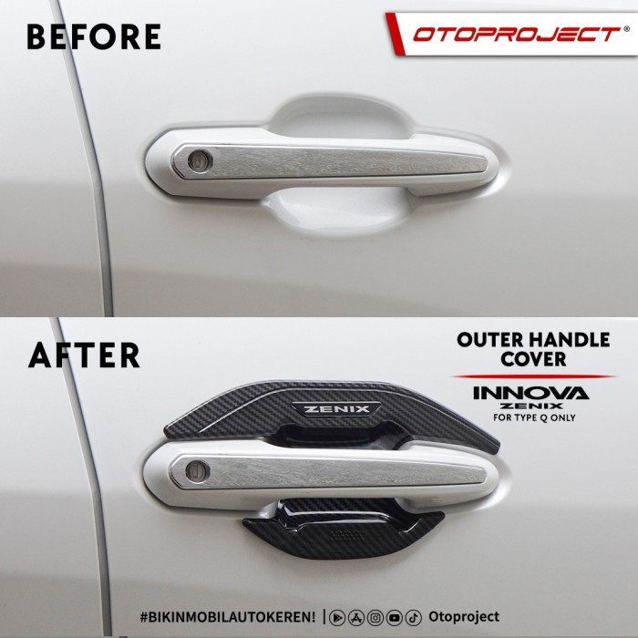 Otoproject - Outer Handle Premium Zenix