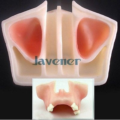 Dental Tooth Implant Practice Maxillary Model Teaching
