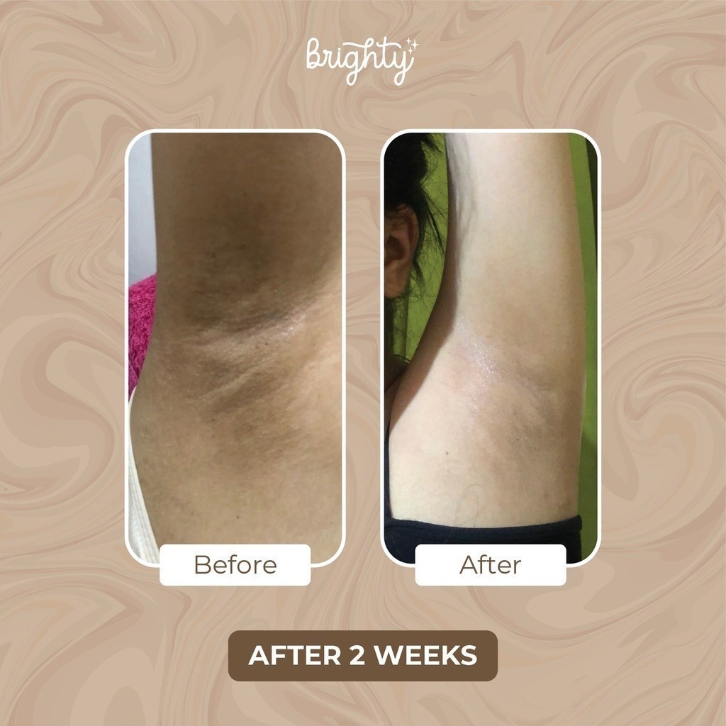 [BUNDLE GLOWING] Brighty Glowing Underarm Paket 2 pcs
