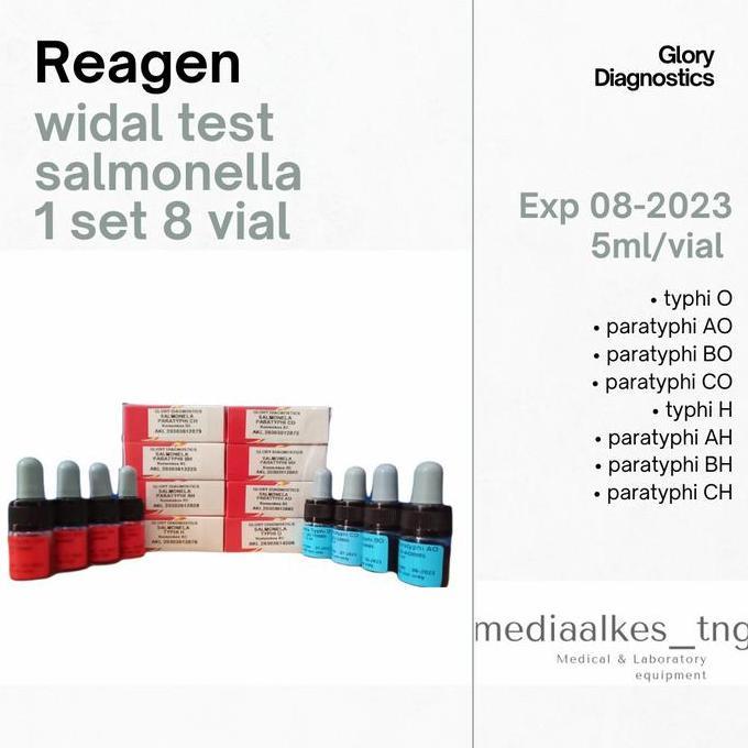 Widal Test Salmonella Glory Diagnostics 1 set 8 vial