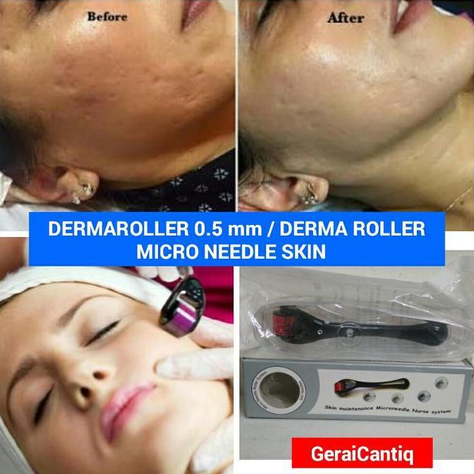 DERMAROLLER 1,0 mm / DERMA ROLLER MICRO 540 NEEDLE SKIN