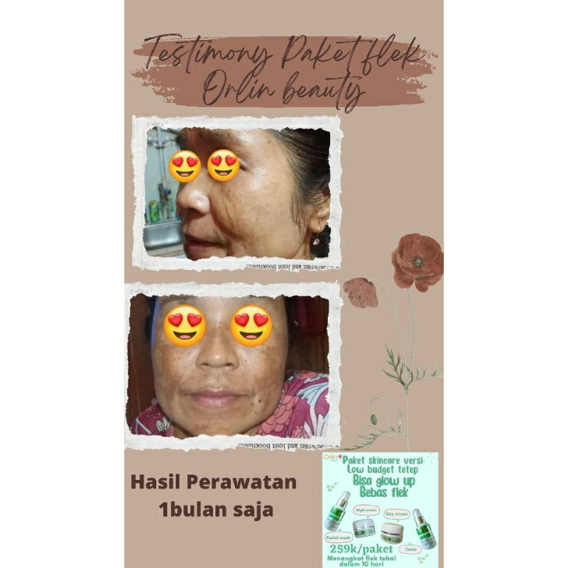 Cream malam flek platinum/ Ecer/BPOM/COD