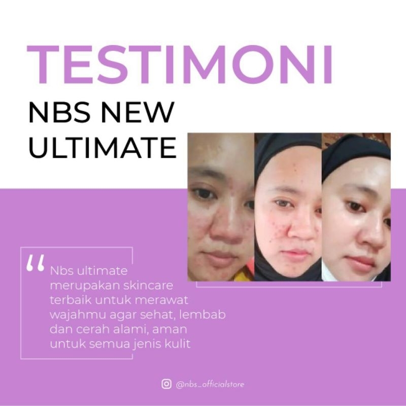 NBS Ultimate Free mini gold