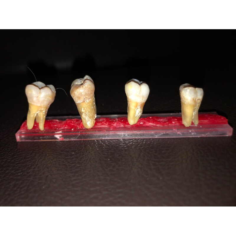 Gigi asli molar