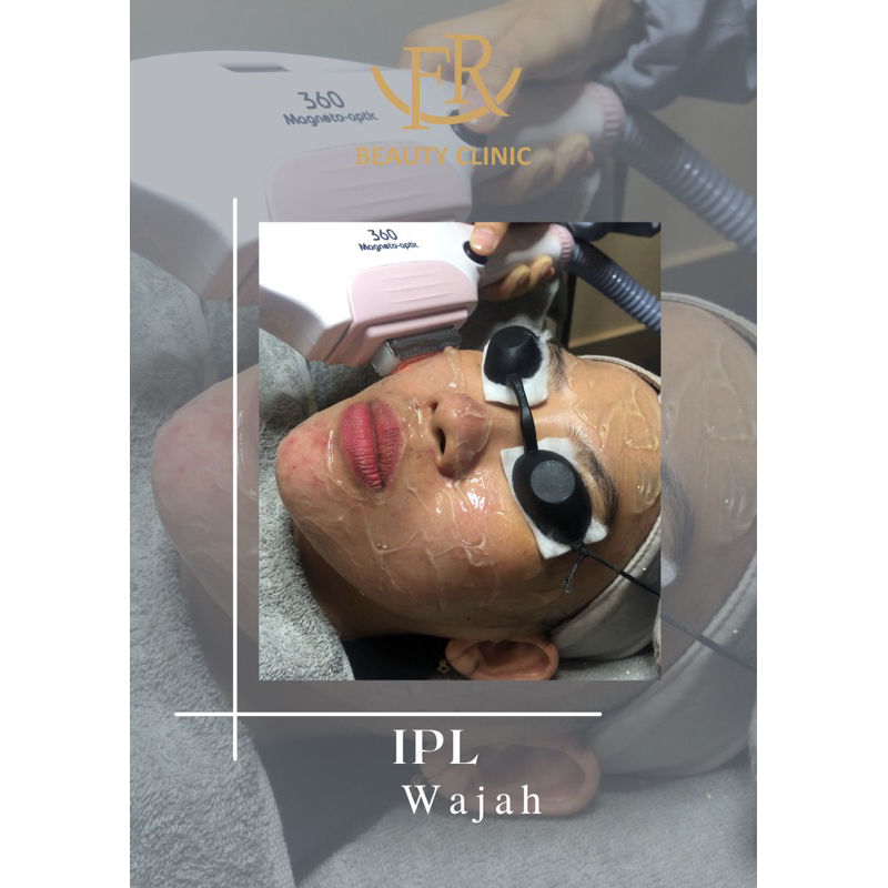 IPL Wajah